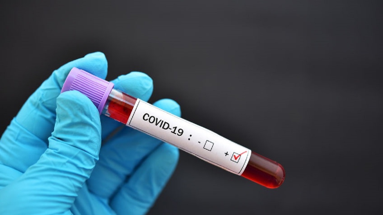 ކޯވިޑް-19: އެއް މަހުގެ ކުއްޖަކު ސީރިއަސްވެ ފަރުވާދެނީ