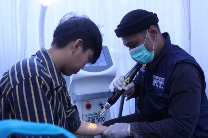 An Indonesian undergoes a tattoo removal procedure in Jakarta, Apr. 1, 2024. (Bazis Baznas DKI Jakarta)
