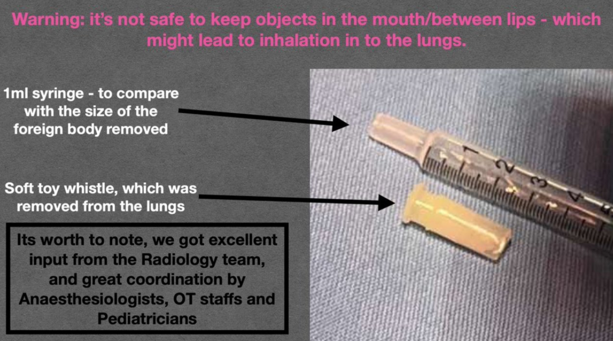 ކުޑަކުއްޖެއްގެ ފުއްޕާމެއިން ކުޅޭއެއްޗެއްގެ އަޑުގޮވާ ތަންކޮޅު ނަގައިފި