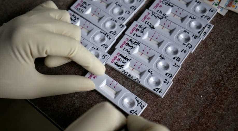 90 މިނެޓު ތެރޭ އޮމިކްރޯން ވޭރިއަންޓް ދެނެގަނެވޭނެ ޓެސްޓެއް