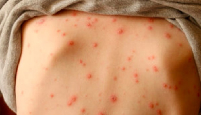 ސަމާލުވޭ؛ ފާނަބަސަންދު ޖެހޭ މީހުން އިތުރުވަނީ