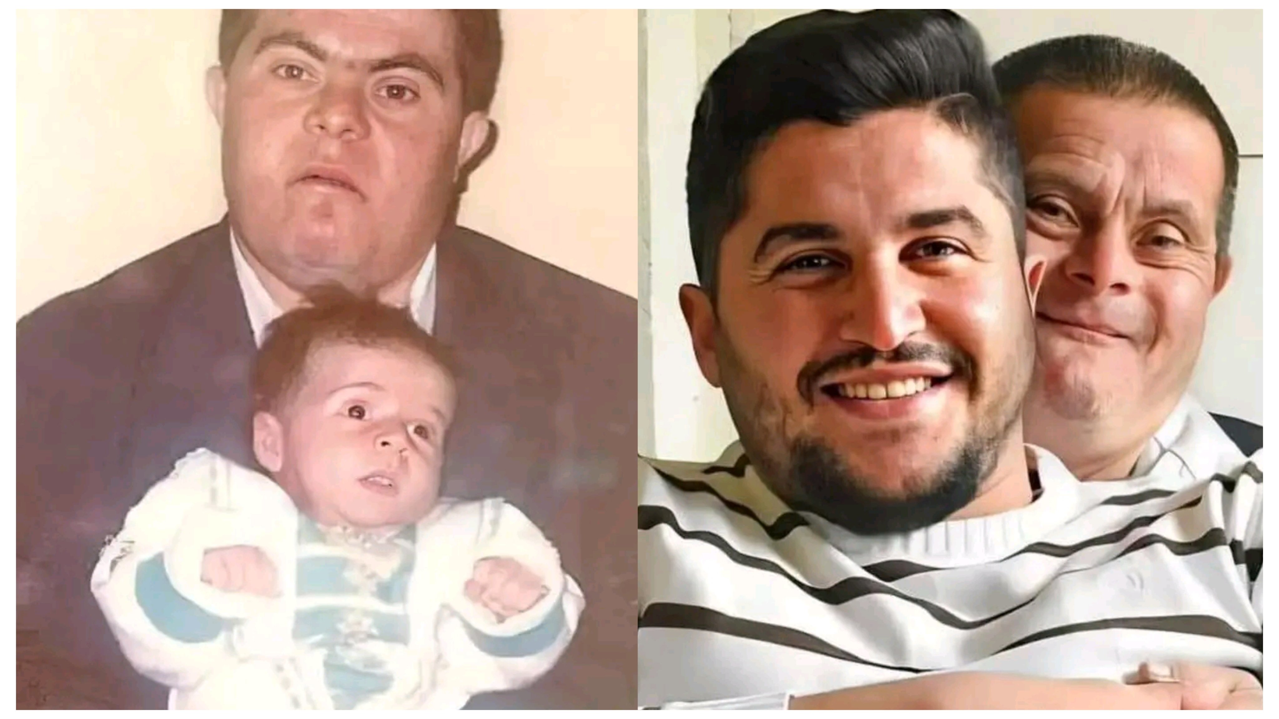 ޑައުން ސިންޑްރޯމް ހުންނަ ބައްޕައަކު ބަލާބޮޑުކުރި ދަރިފުޅު މިއަދު އެއީ ކާމިޔާބު ޑޮކްޓަރެއް