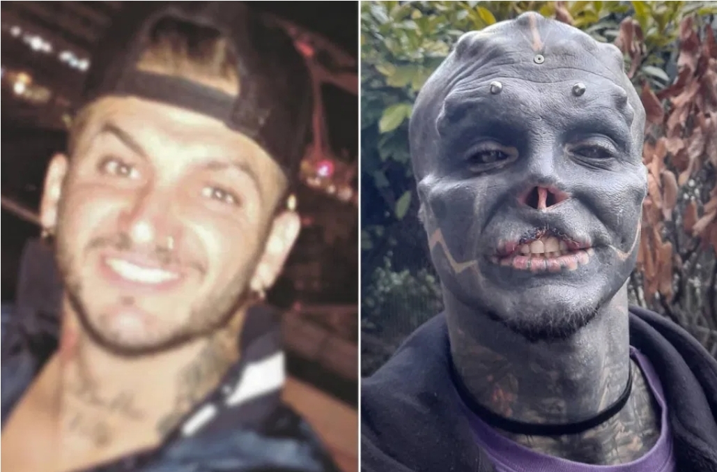 ތުންފަތާ ނޭފަތް ބުރިކޮށްލައިގެން އޭލިއަނަކަށް ވާން އުޅޭ މީހެއް