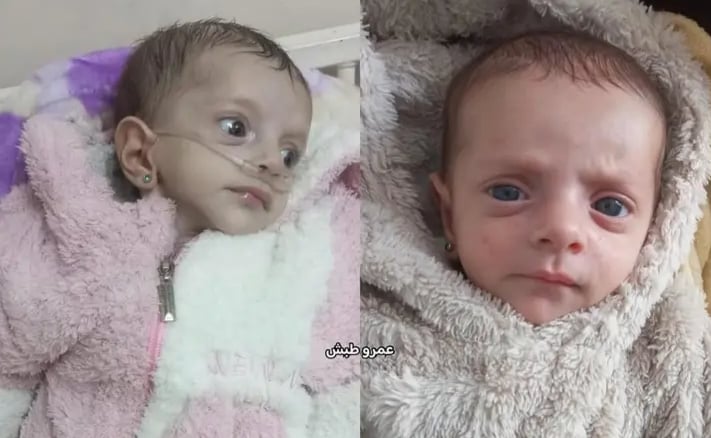 ގާޒާގެ ތުއްތު އާލްމާގެ ފުރާނަ ސަލާމަތްކުރުމަށް އަވަސް އެހީއަށް އެދި އާދޭސްކުރަނީ