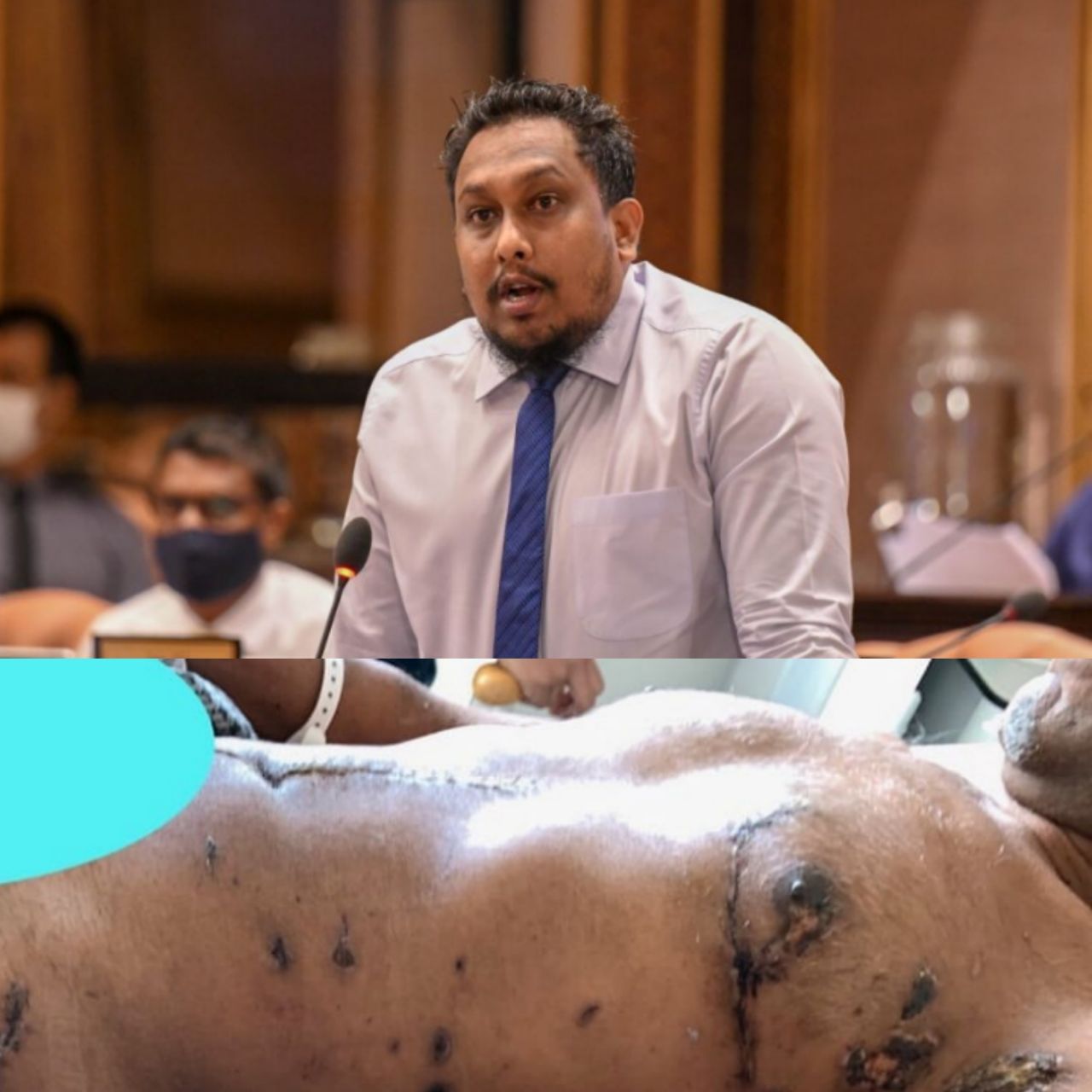 ޒަޚަމްތައް ދައްކާލުމަށް މިރޭ އާންމުކުރި ފޮޓޯ މޮސްޓާ ސިފަކުރެއްވީ "ބަރަހަނާ" ފޮޓޯއެއްގެ ގޮތުގައި